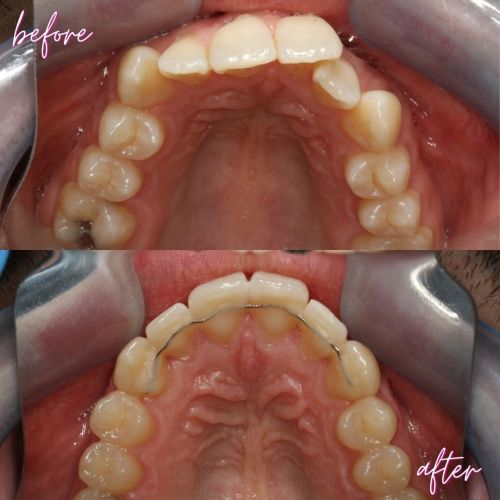 Cosmetic Dentistry - 740 Dental Cosmetic Dentistry - 740 Dental