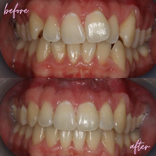 Cosmetic Dentistry - 740 Dental