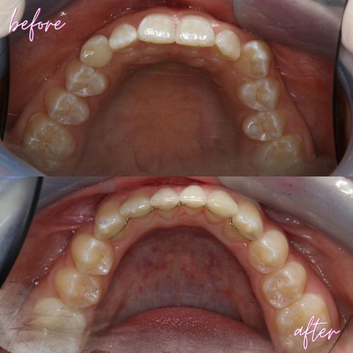 Cosmetic Dentistry - 740 Dental Cosmetic Dentistry - 740 Dental