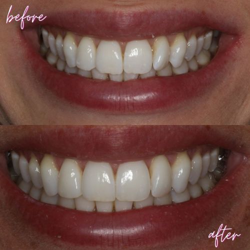 Cosmetic Dentistry - 740 Dental