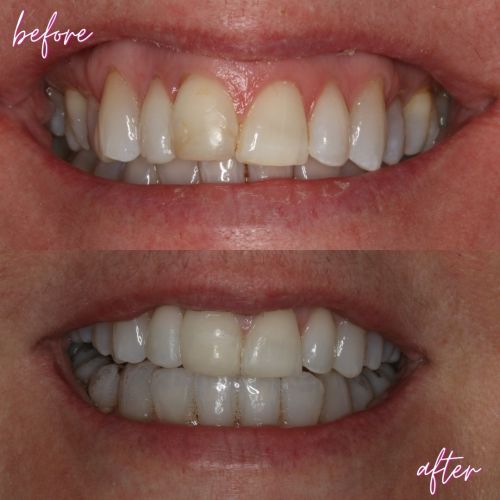 Cosmetic Dentistry - 740 Dental Cosmetic Dentistry - 740 Dental